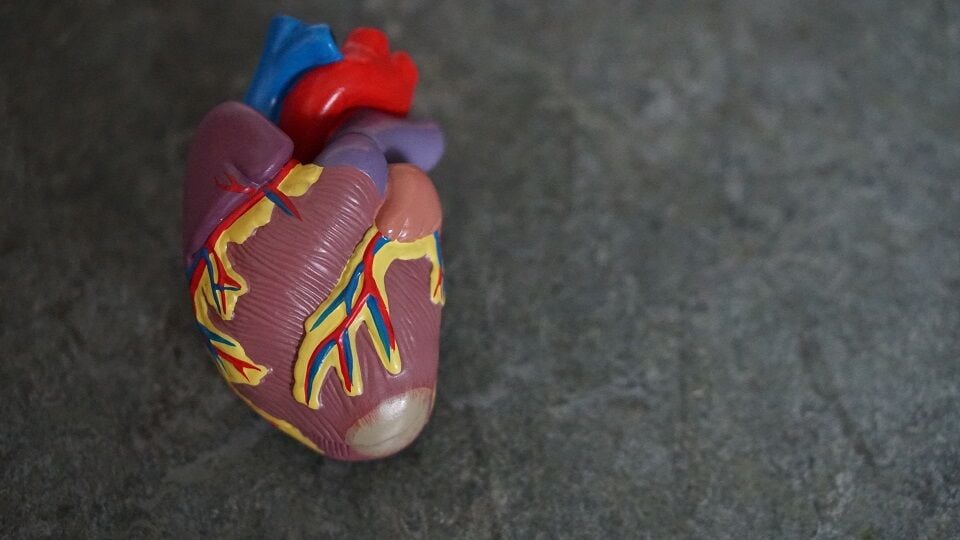 La vida continúa después de un infarto de miocardio